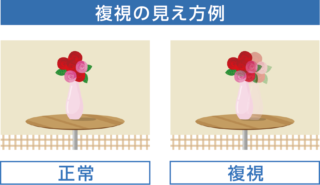 視野障害