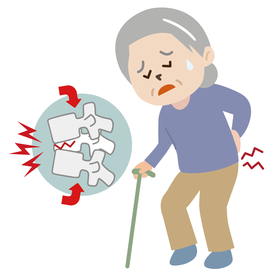 脊椎圧迫骨折（せきついあっぱくこっせつ）