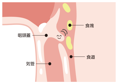 のどまわりの筋肉量の低下 食塊（しょっかい）が口から食道に運ばれると、咽頭蓋（いんとうがい）と食堂が気管の入口にフタをして奥にはいらないようにします。
