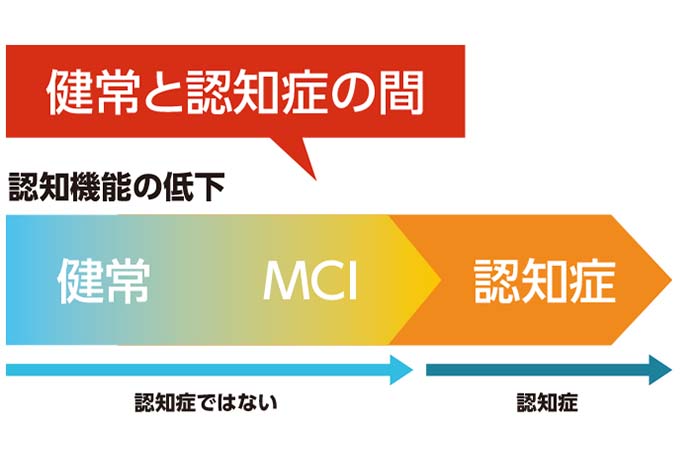 軽度認知障害とは何ですか?
