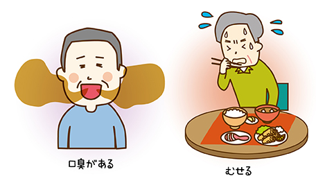 こんな症状が出たら要注意！口腔（こうくう）機能低下のサインとは？ 口臭がある、むせる