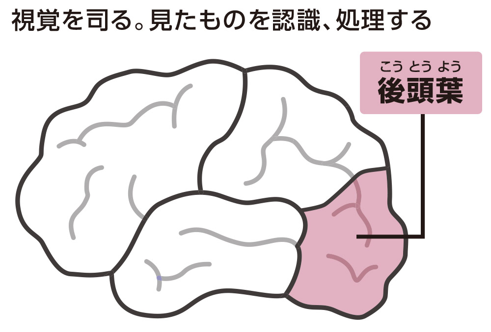 レビー小体型認知症　後頭葉（こうとうよう）：資格を司る。見たものを認識、処理する/海馬：記憶を司る。大脳辺縁系（脳の奥）の一部